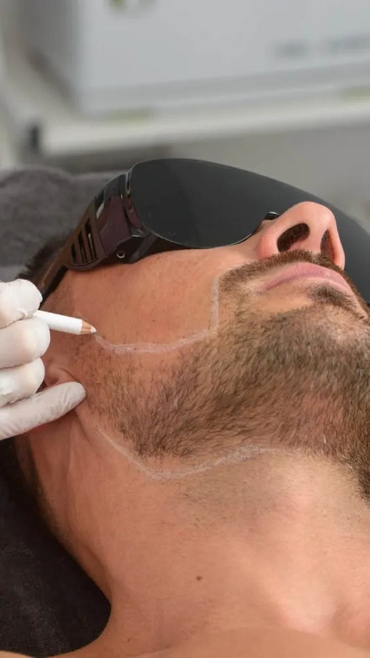Plan Depilación láser Perfilado de barba