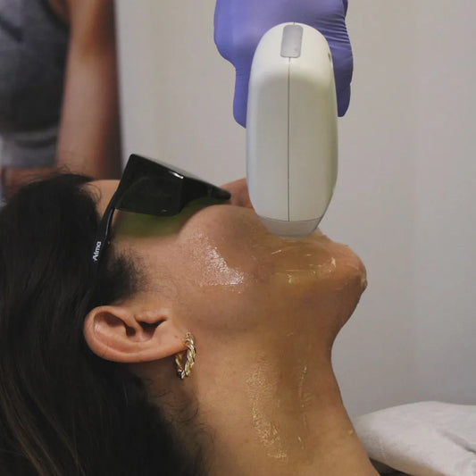 Plan Depilación láser Rostro Completo